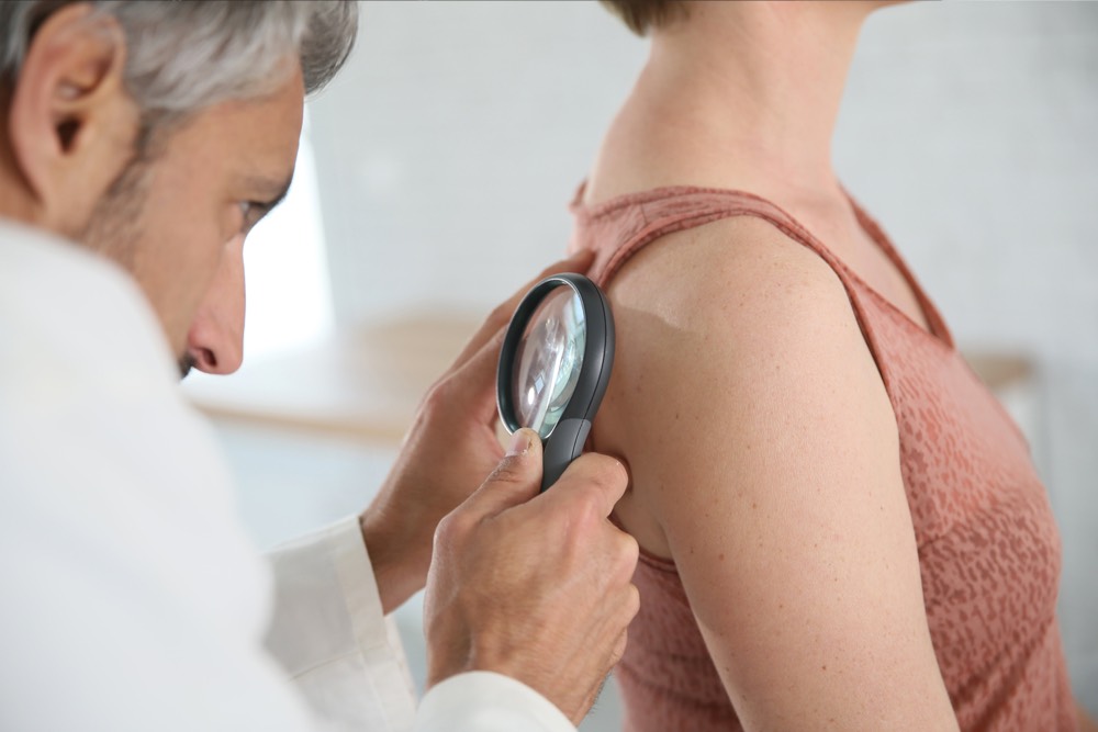 Symptoms, Treatment, and Prevention of Melanoma