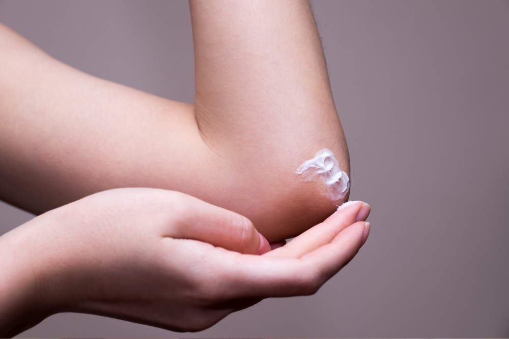 Probiotics to Manage Eczema and Atopic Dermatitis