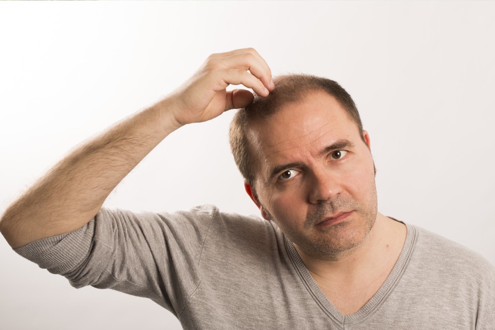 Warning Signs and Treatment for Male Pattern Baldness